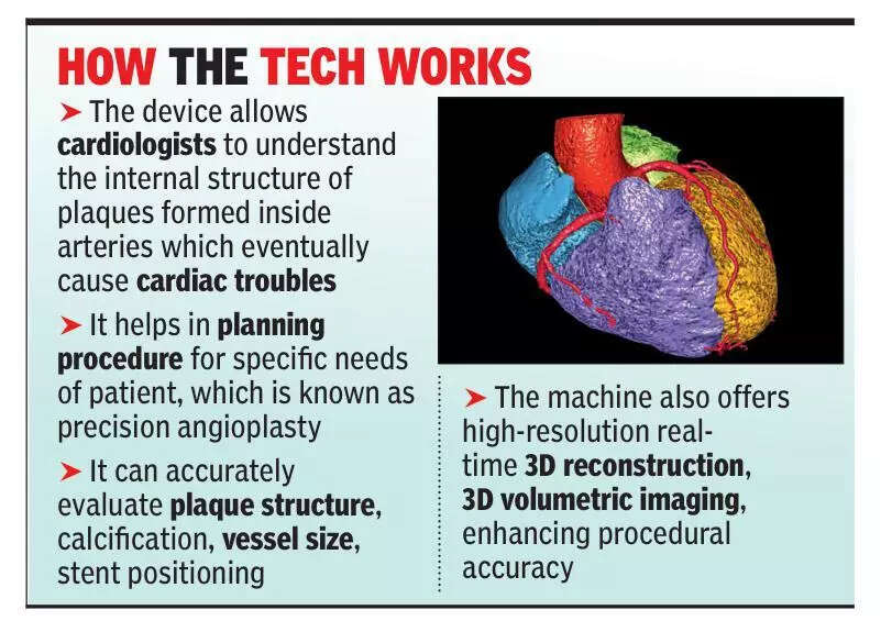 SGPGI gets AI-enabled cardiac imaging technology for precision angioplasty
