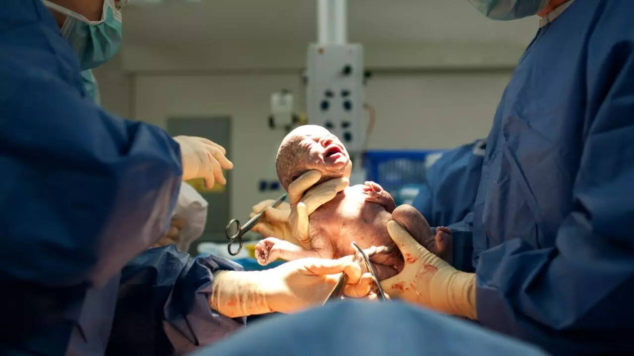 infant delivery