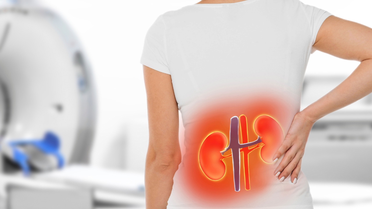 kidney problem