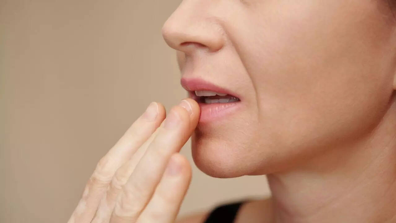 dry mouth
