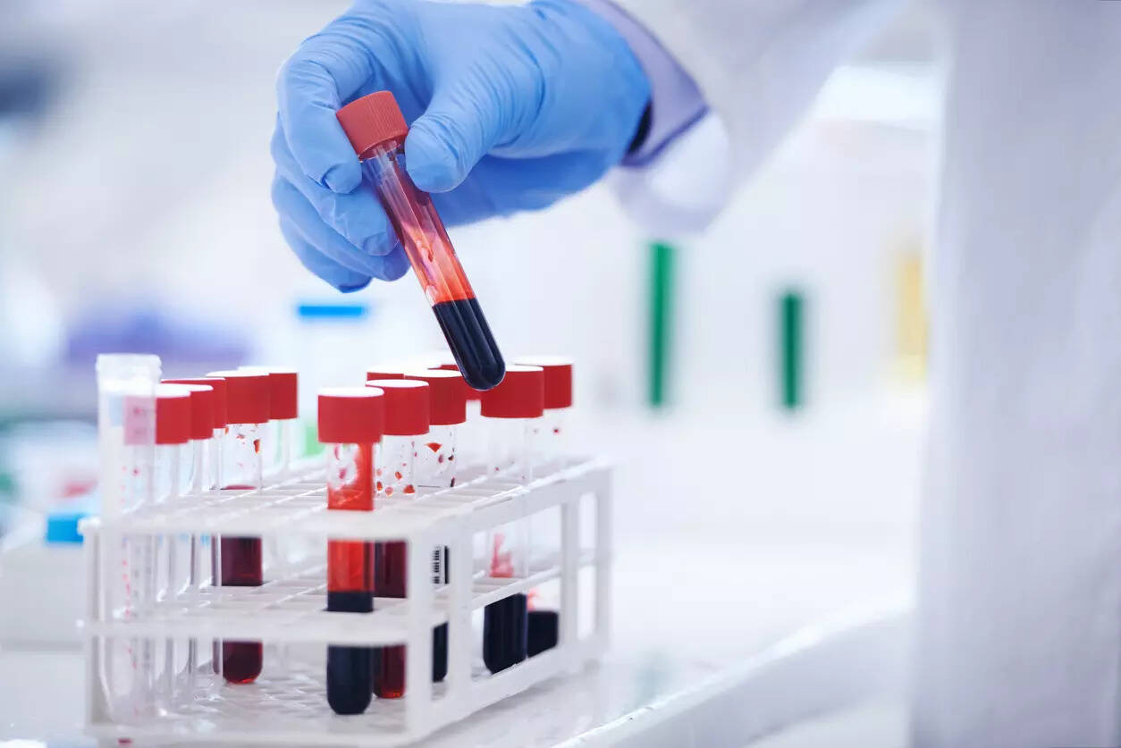 Now, a simple blood test can help doctors identify diabetes risk in elderly