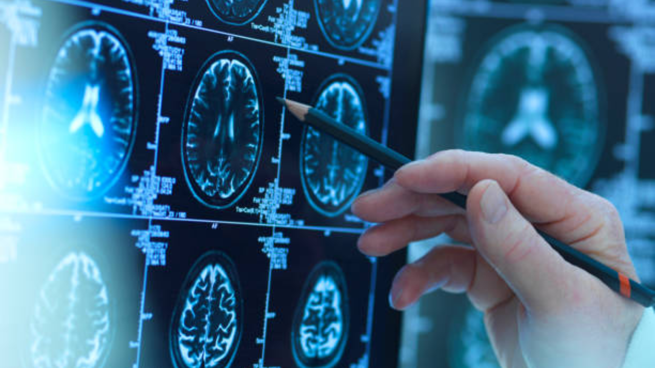 As the world's population ages, early diagnostic technologies that are low-cost become increasingly important