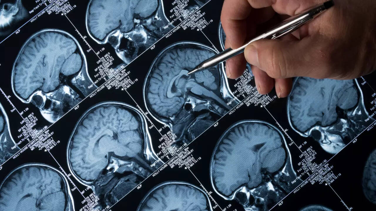 brain