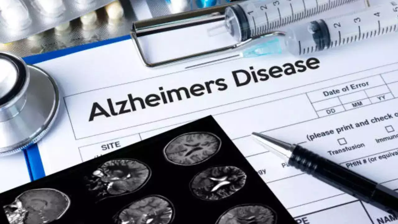 Alzheimer’s