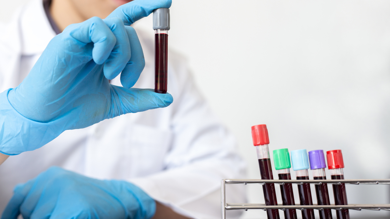 blood group (1)