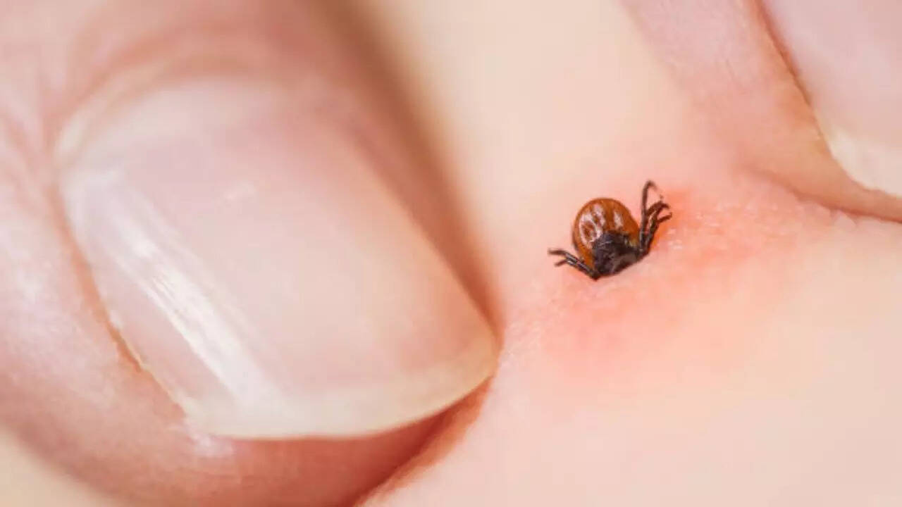Health risks posed by tick bites
