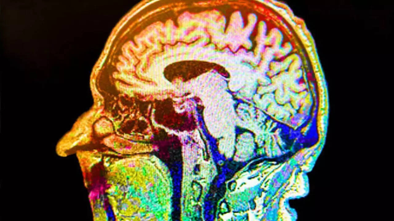 Parkinson’s doesn’t start in the brain?