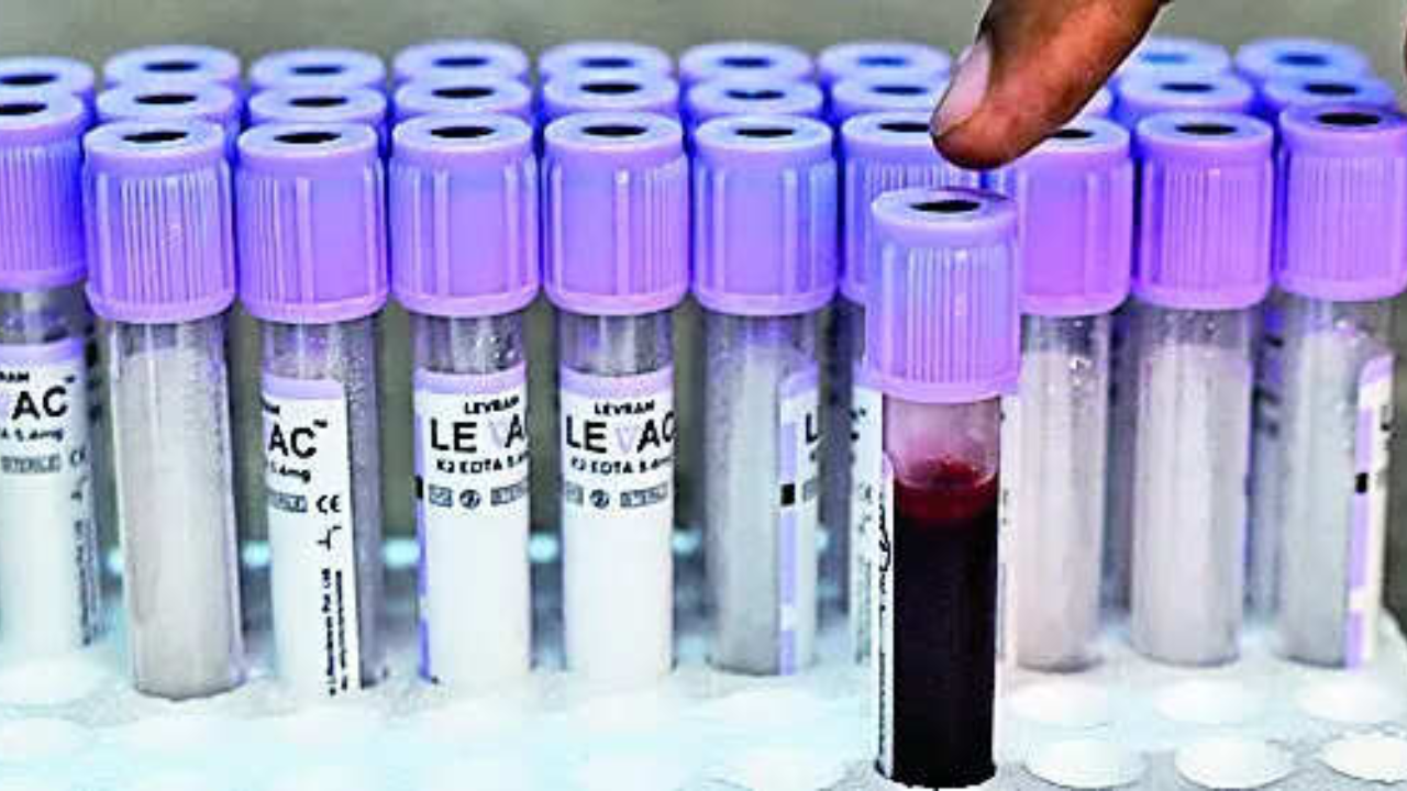 Working round the clock, Telangana Forensic Science Lab identifies 18 bodies as samples continue to arrive from site of factory blast in Hyderabad