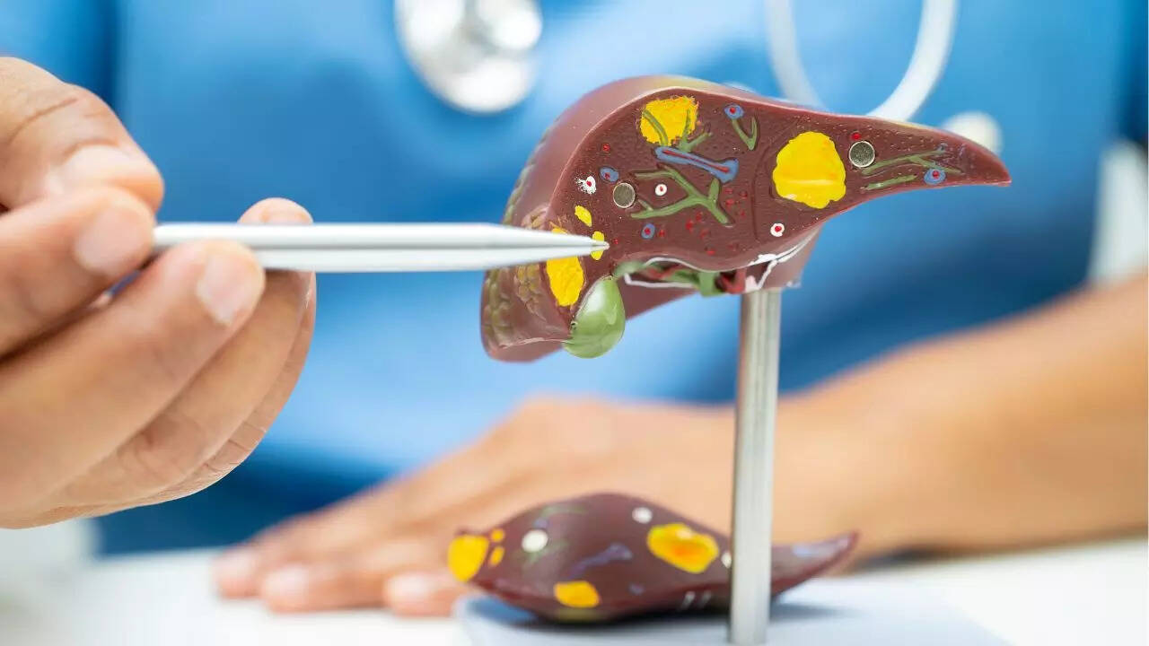 What is gallbladder cancer