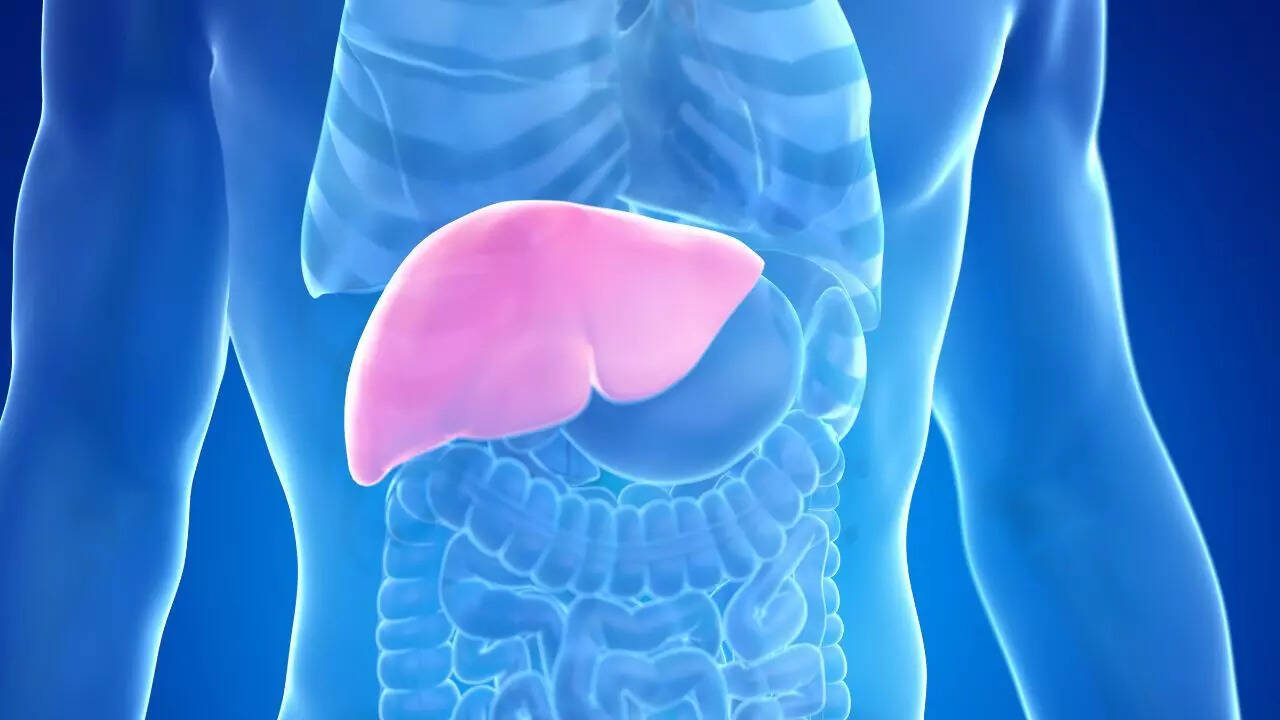 Liver cirrhosis