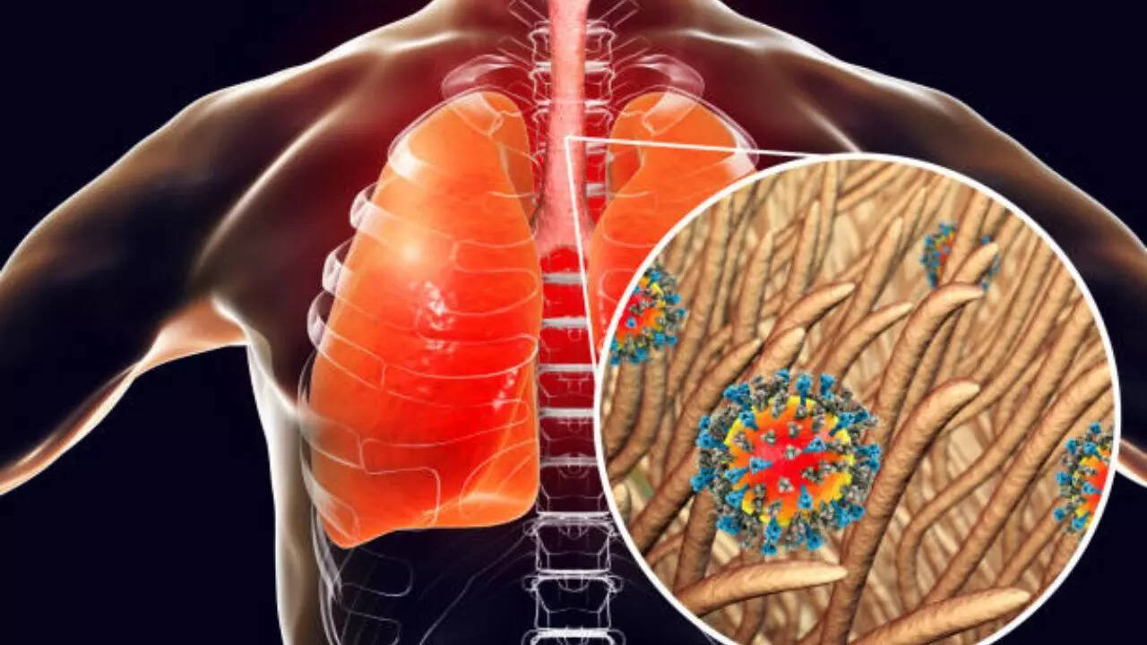 Measles is a highly contagious respiratory disease