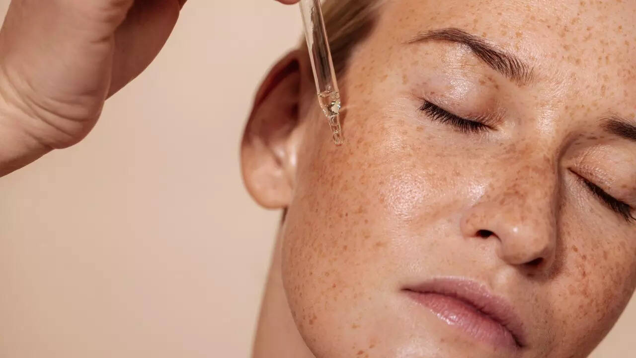 Acne (2)