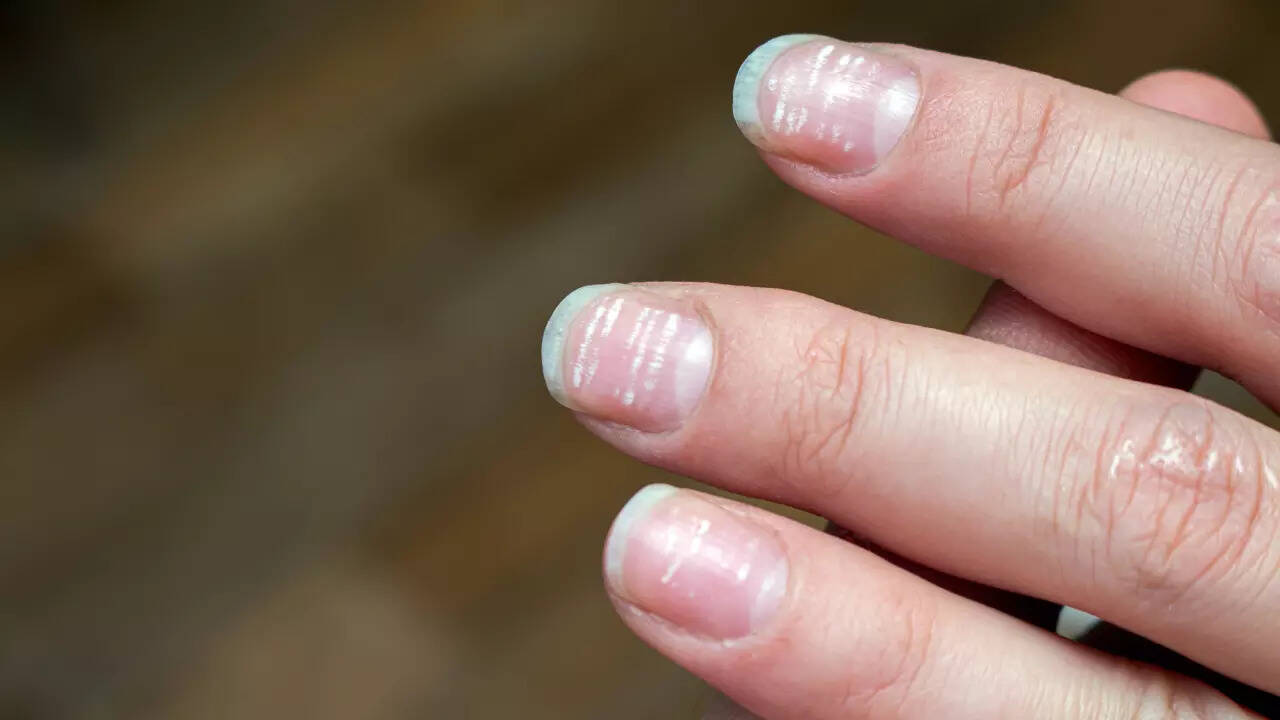 nail