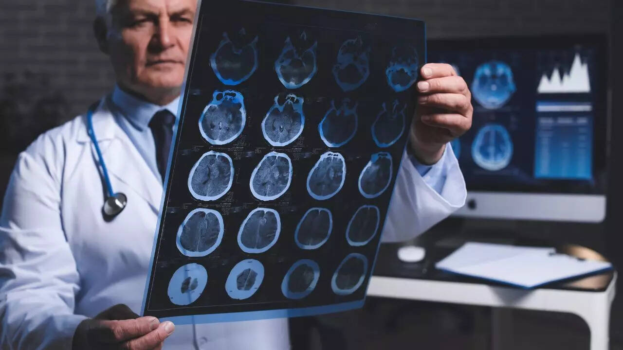 Early-onset Alzheimer’s diagnosis