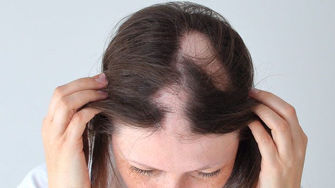 Dealing with skin conditions like alopecia