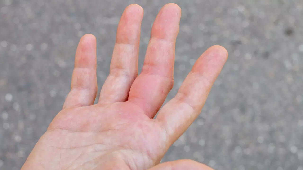 palm