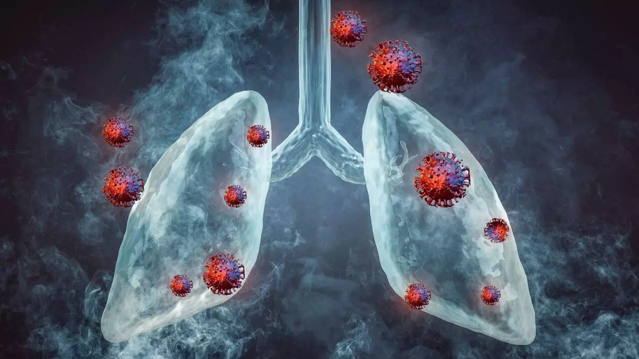 Delhi’s toxic air linked to surge in non-smoker lung cancer cases