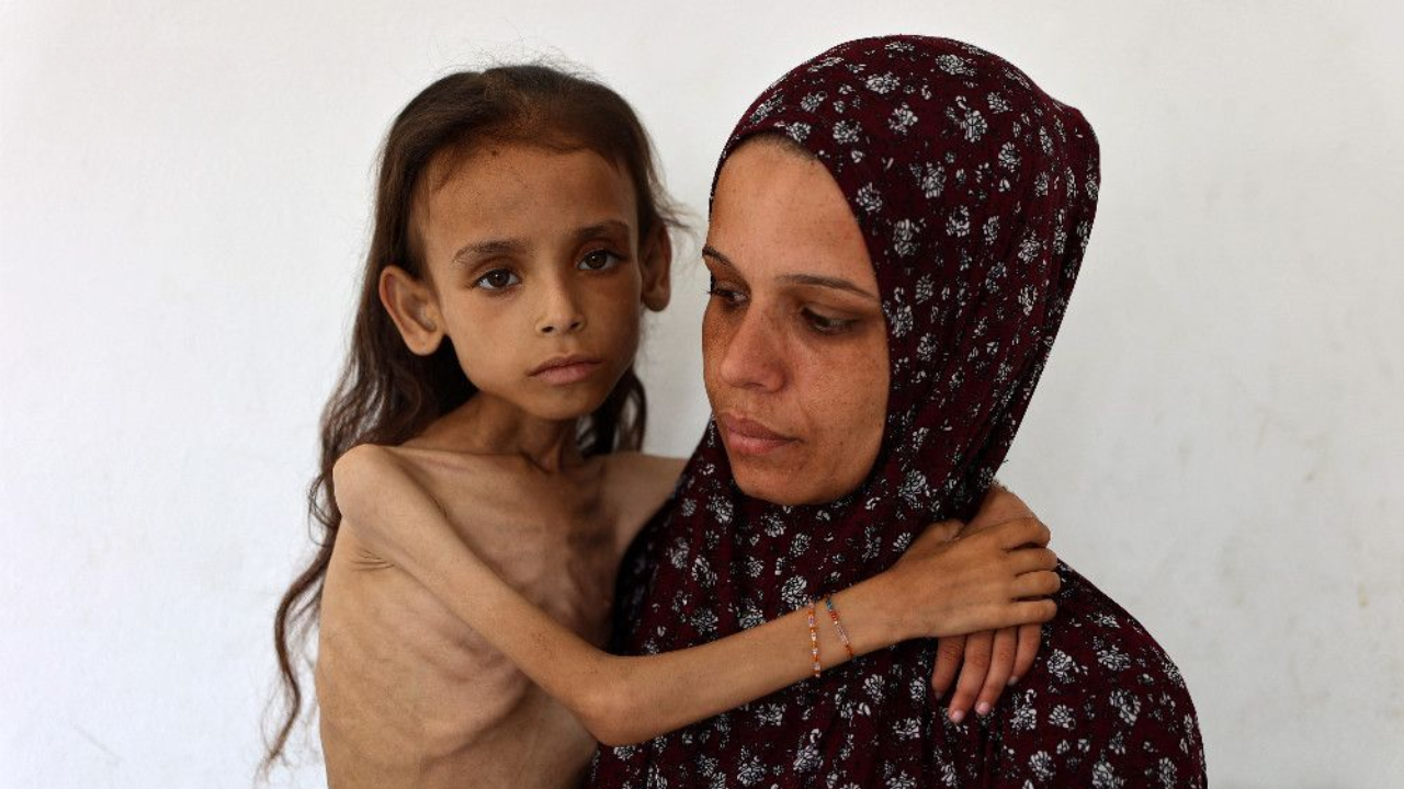 Her bones tell Gaza story, but Grok thinks it is Yemen: Musk’s chatbot flagged for false claims on starving girl photo – Can AI be trusted?