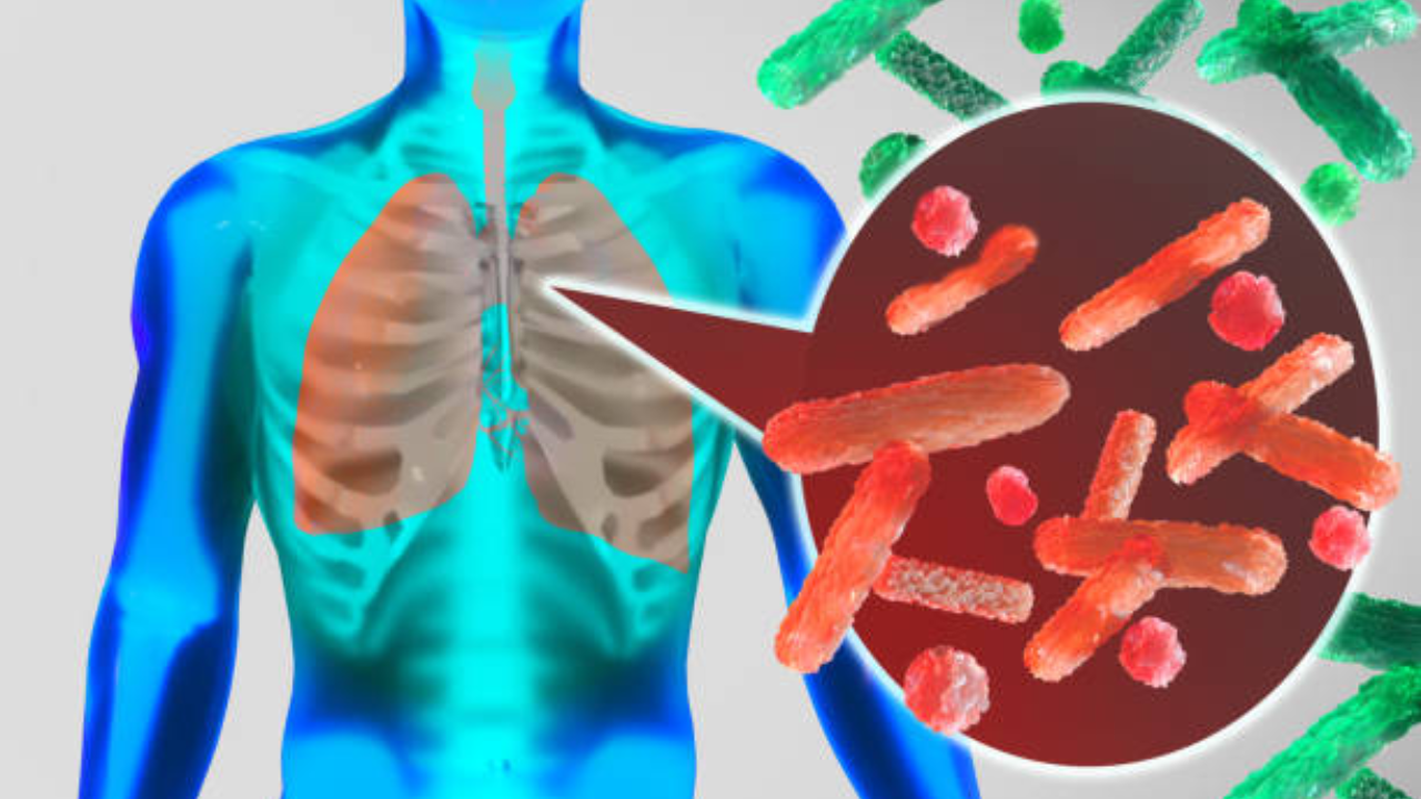 Legionnaires’ disease and air conditioning: A risk you probably didn’t know about