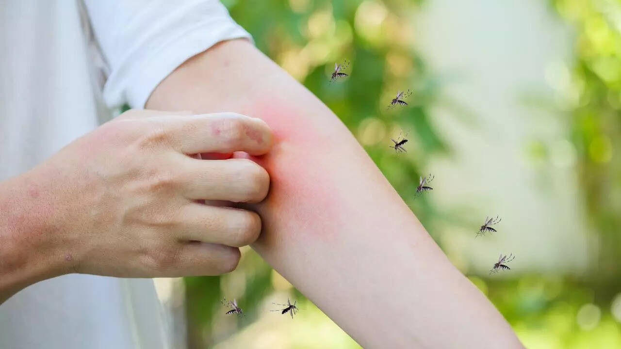 Dengue mimickers: Viral infections that confuse diagnosis