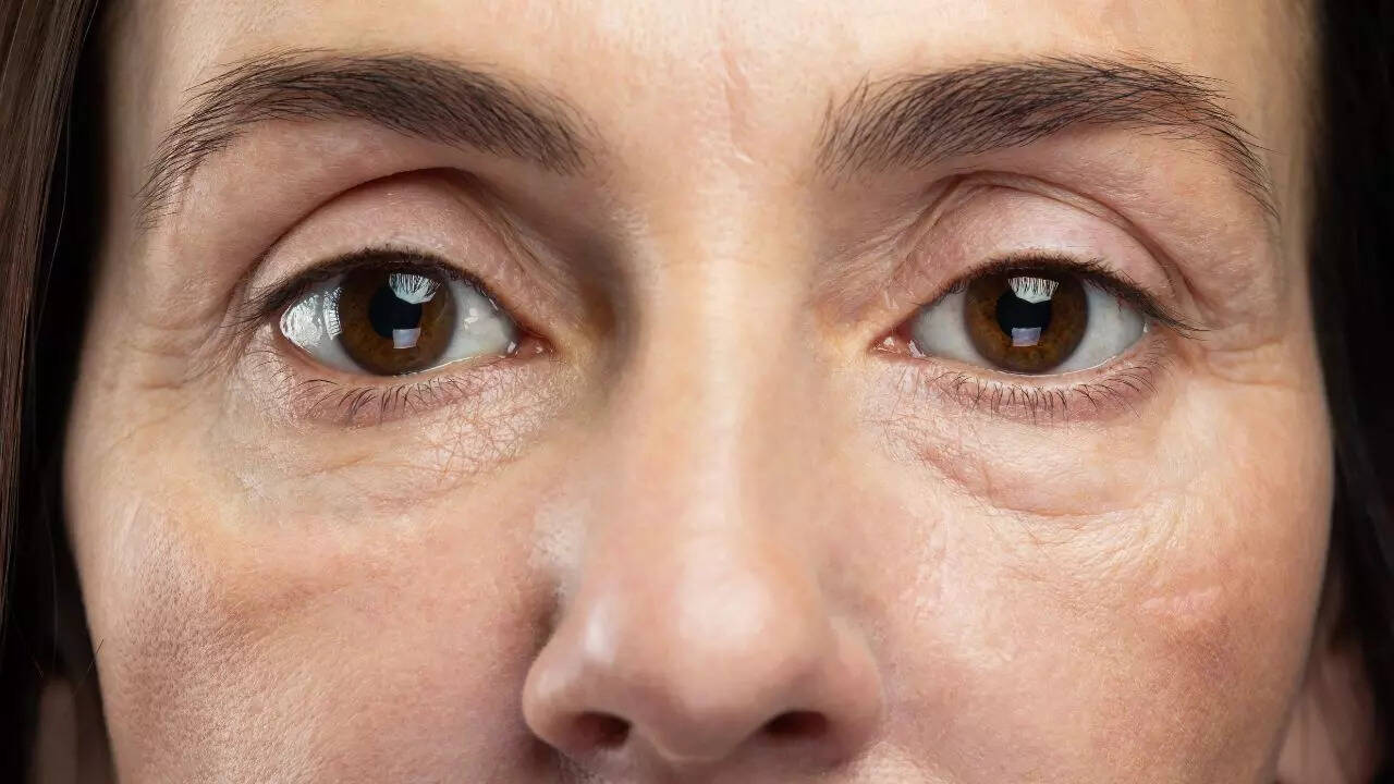 Eye Floaters High Blood Pressure Diabetes Explained