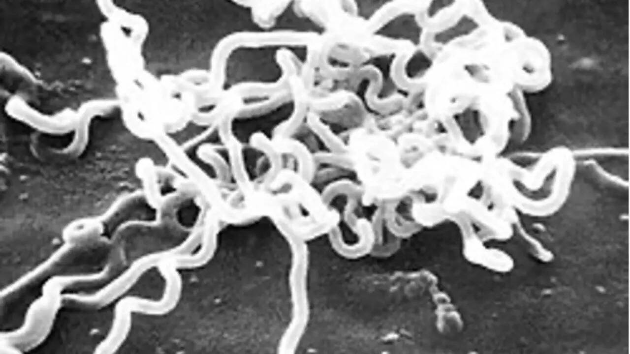 What is congenital syphilis?