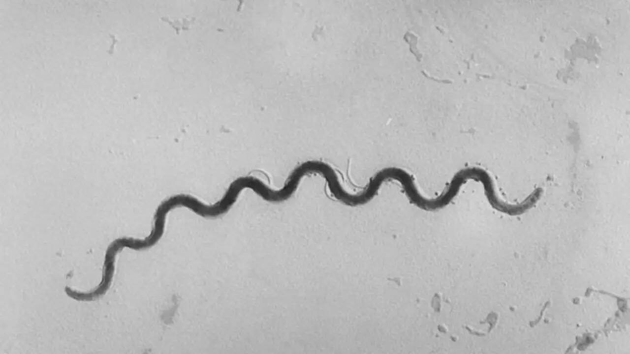 How to prevent congenital syphilis?