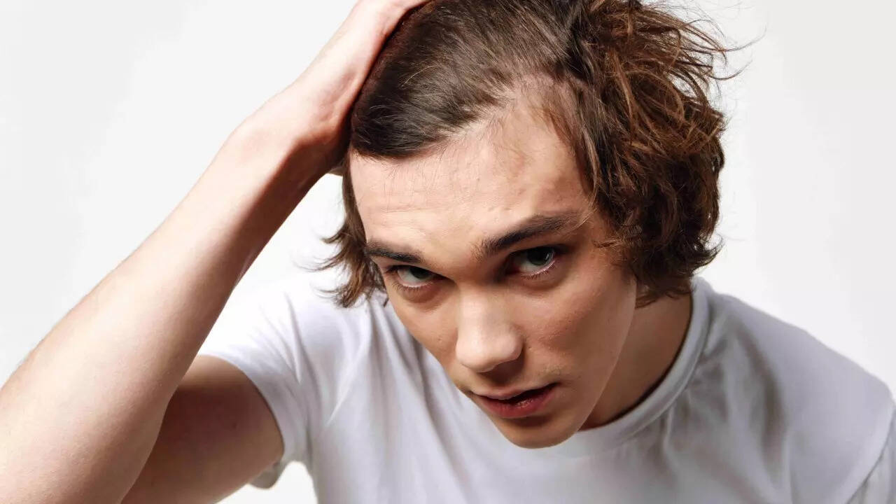 Hair loss (3)