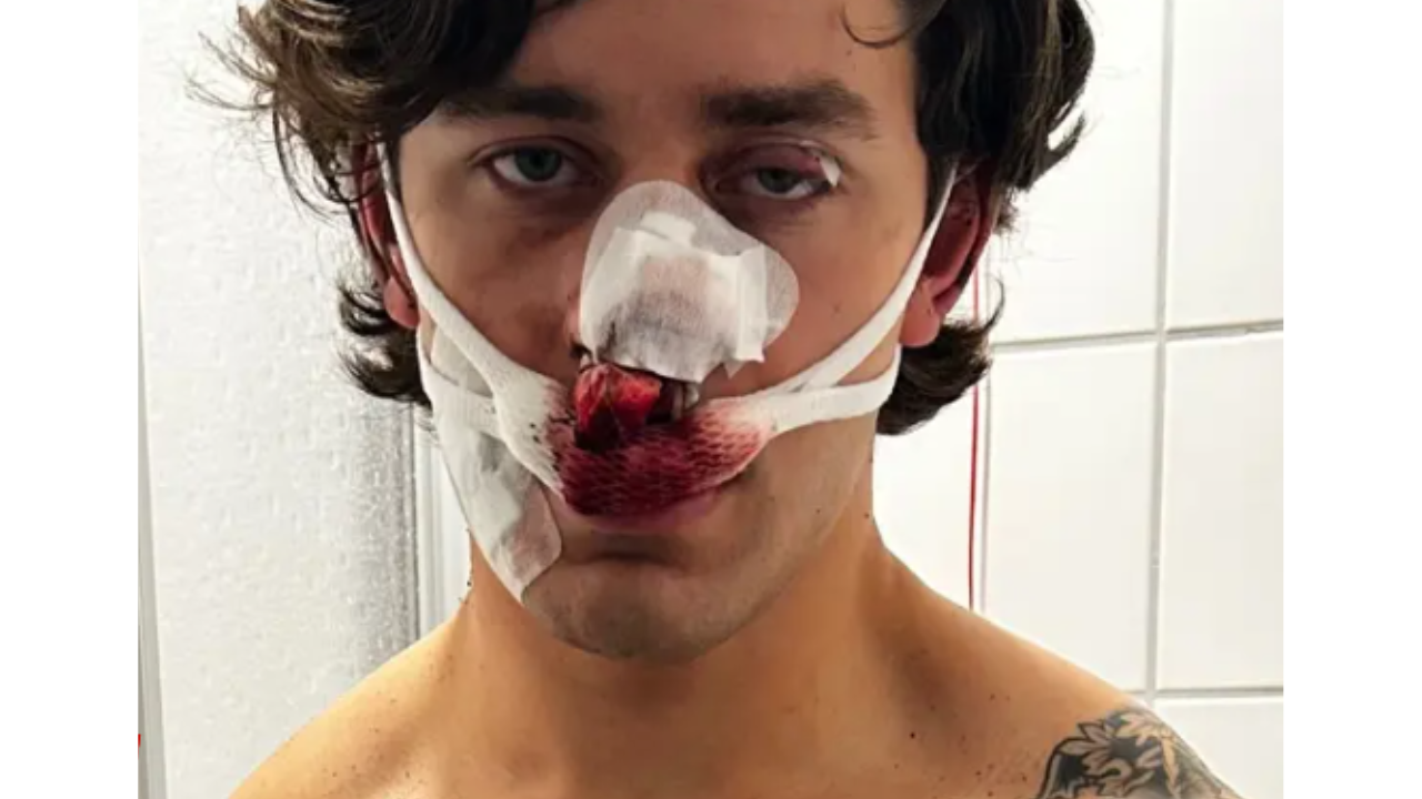 US man stabbed in Germany: 21-yr-old NY model severely injured while trying to save 2 women from local thugs; who is John Rudat?