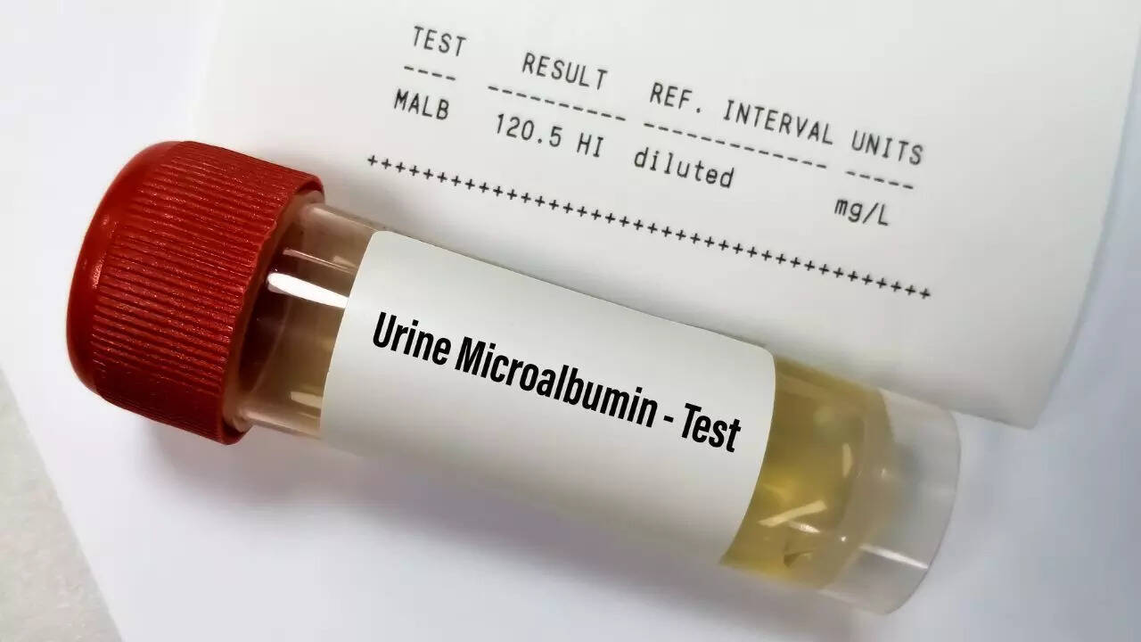 What a urine test can reveal about your health