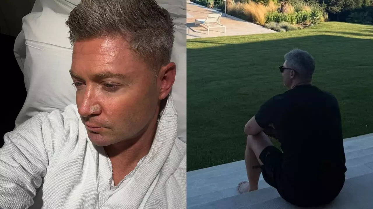 Michael Clarke has skin cancer removed from his nose - shares photo