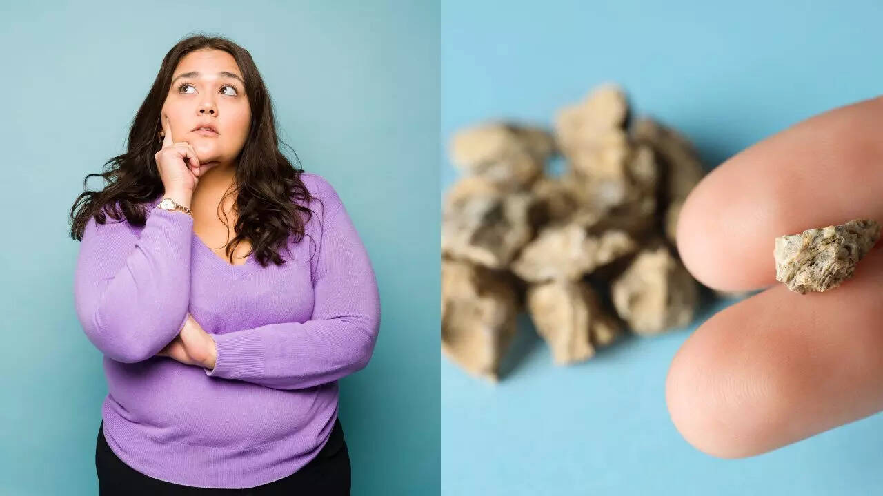 How being overweight contributes to kidney stones and what to do about it