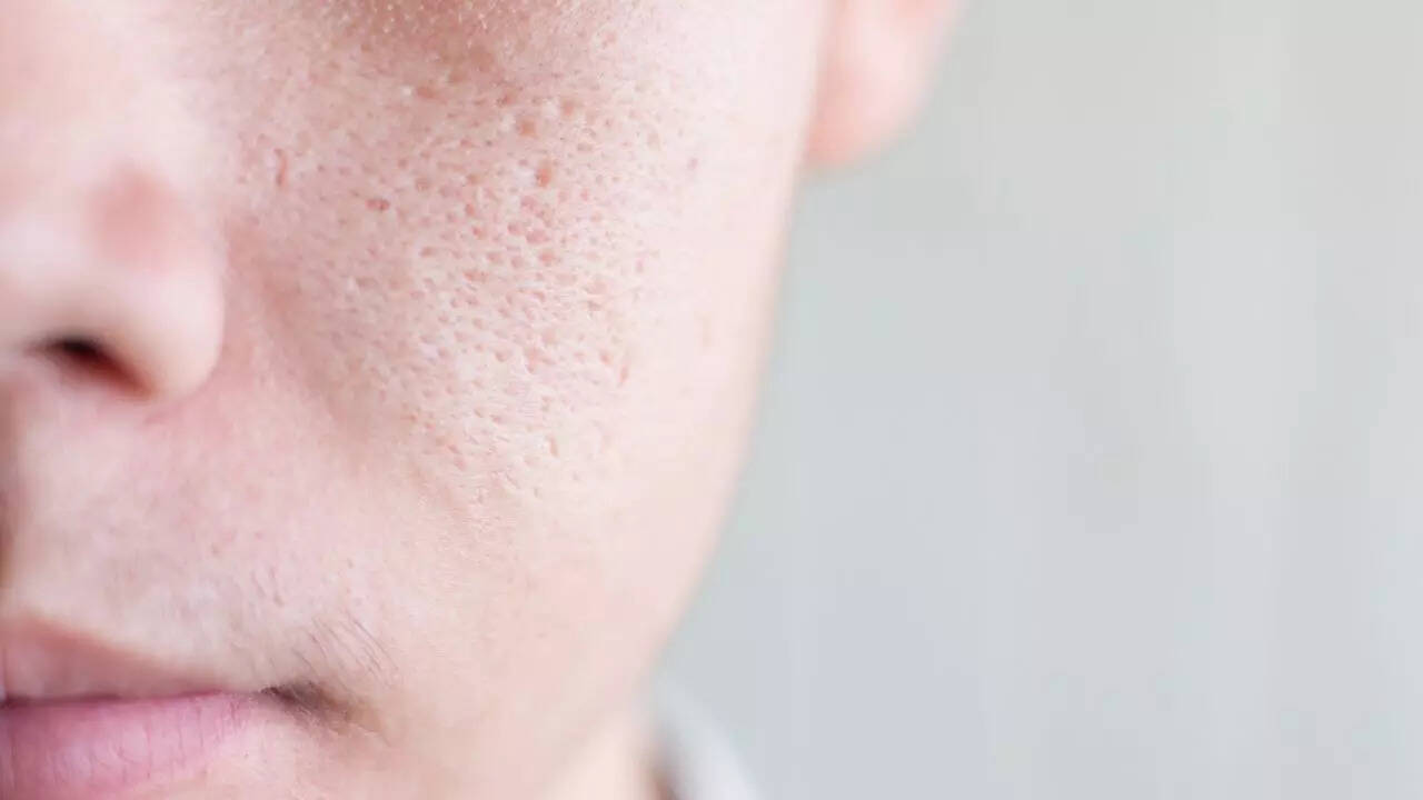 8 effective tips to reduce large pores for smoother skin
