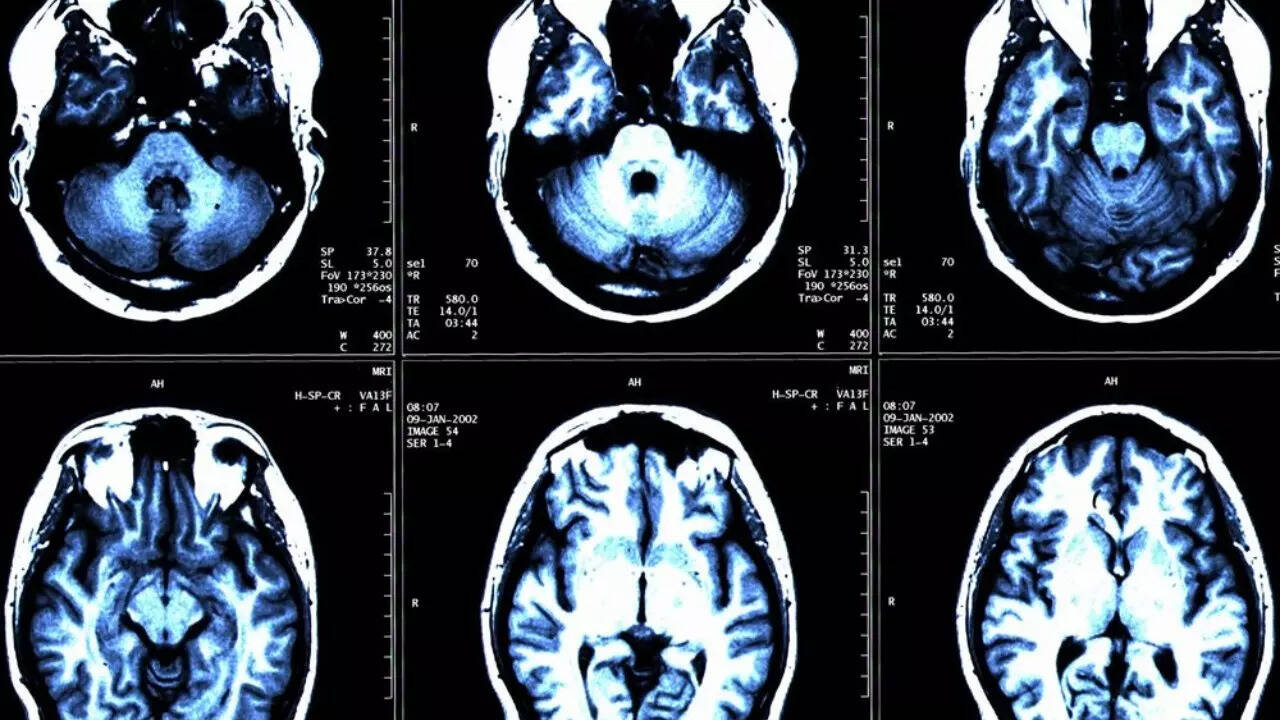 Head injuries (3)