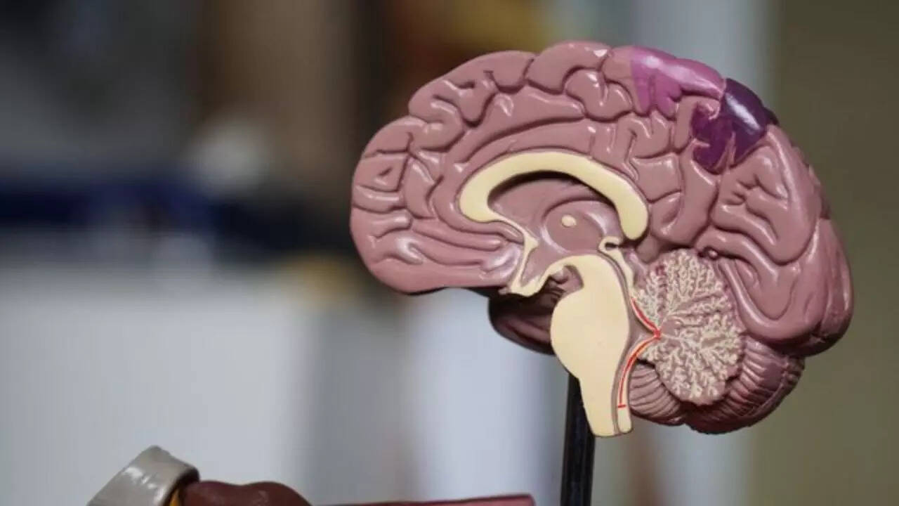 Head injuries (2)
