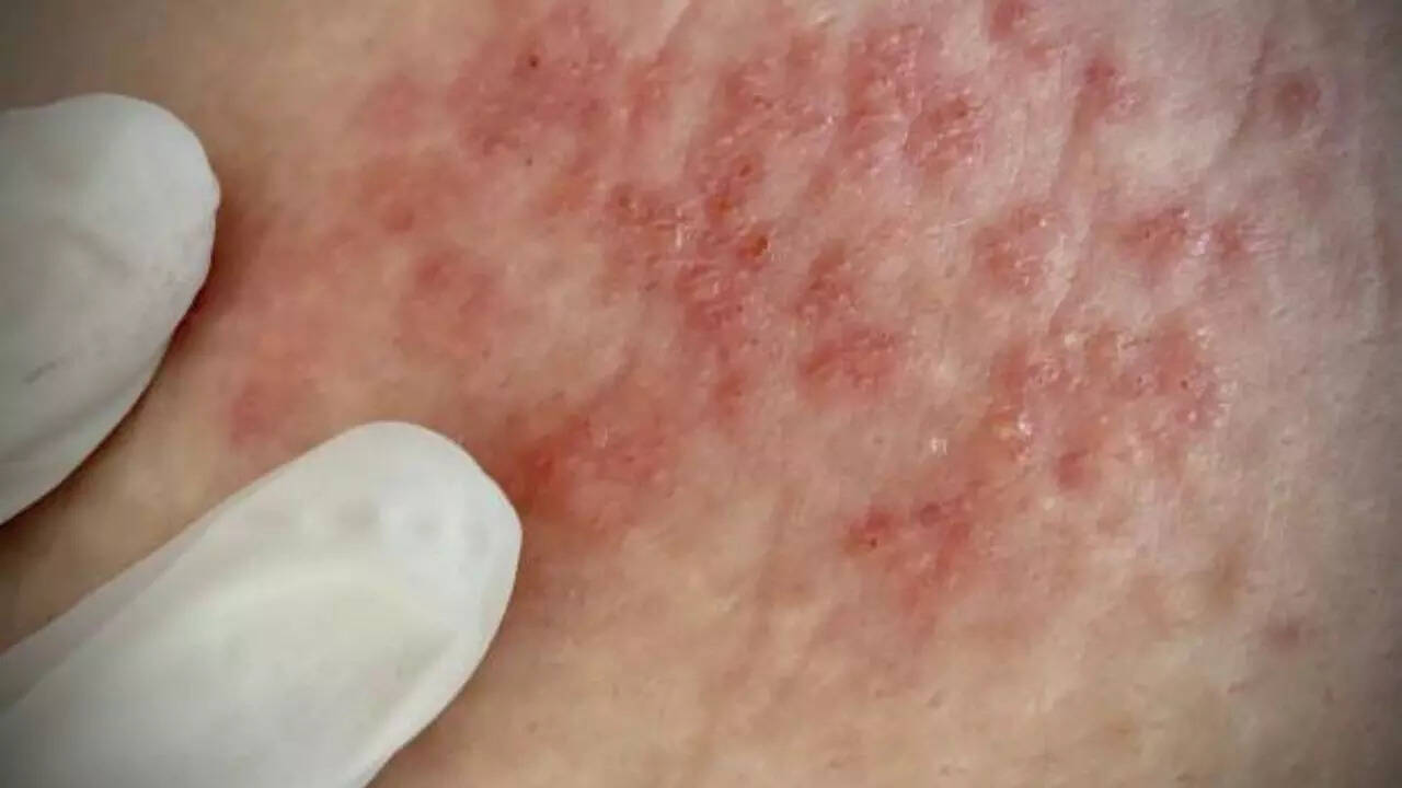 How is AGS diagnosed?