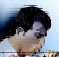 72-year-old farmer recovers after 5-year struggle of aspirating betel nut