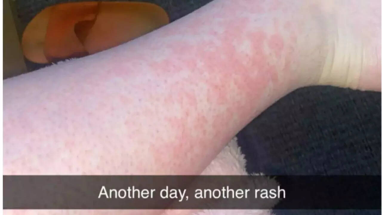 Amber’s early warning signs misunderstood which lead to fatal CML