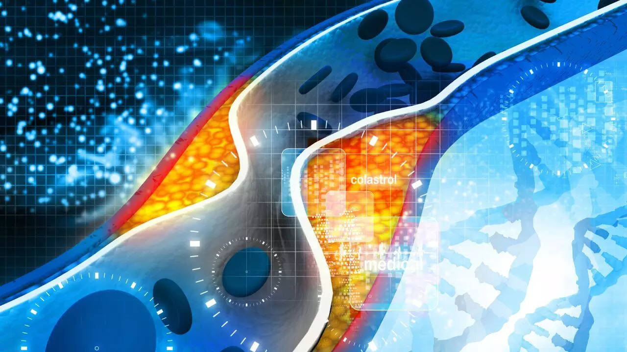 5 things to know about Cholesterol Reducing Drugs