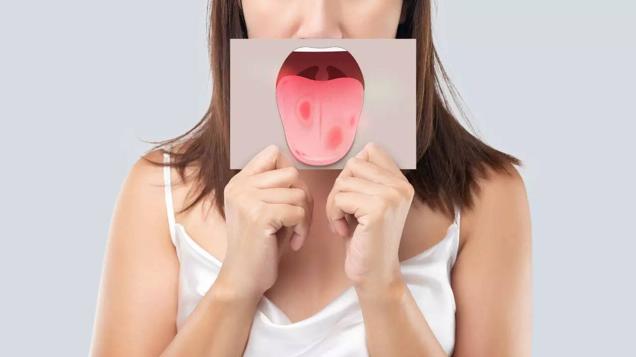 Mouth bacteria and heart attack