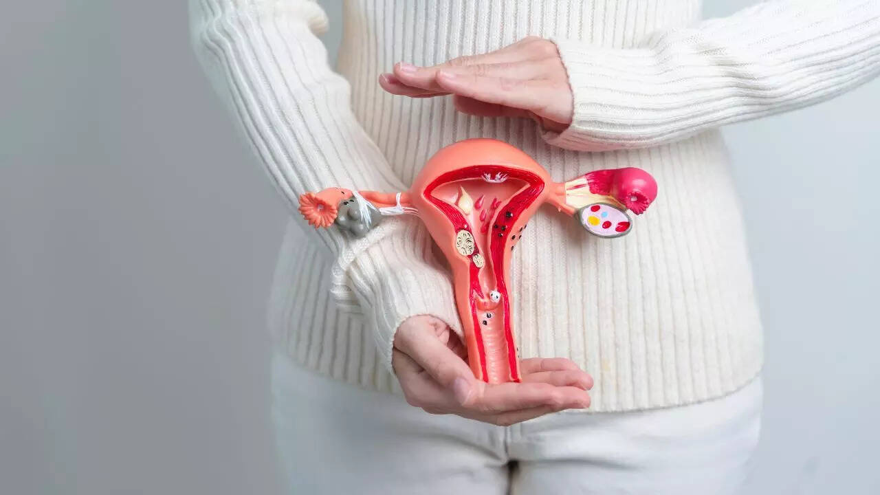 ​Can fibroids and fibroadenomas become cancerous?​ Credits: Canva