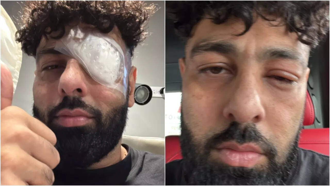Badshah links his eye injury to 'The Ba***ds of Bollywood'