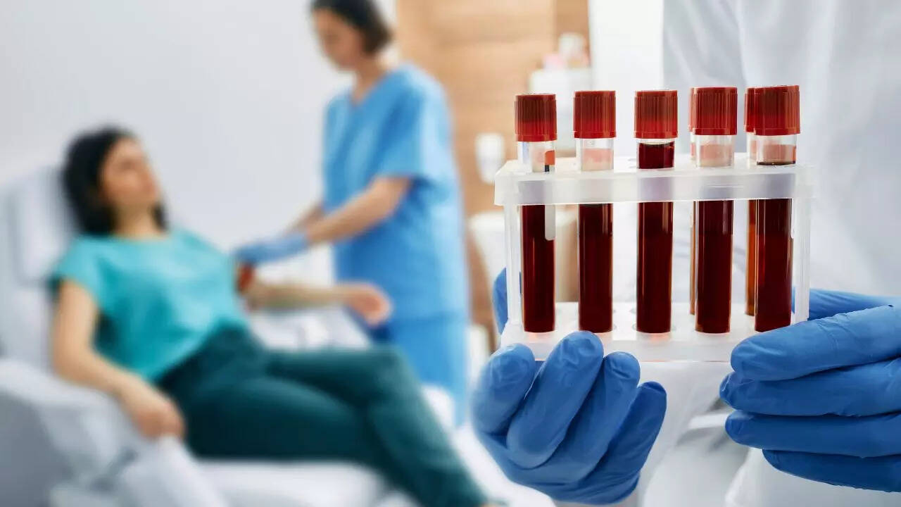Good blood test results (25-Hydroxyvitamin D)