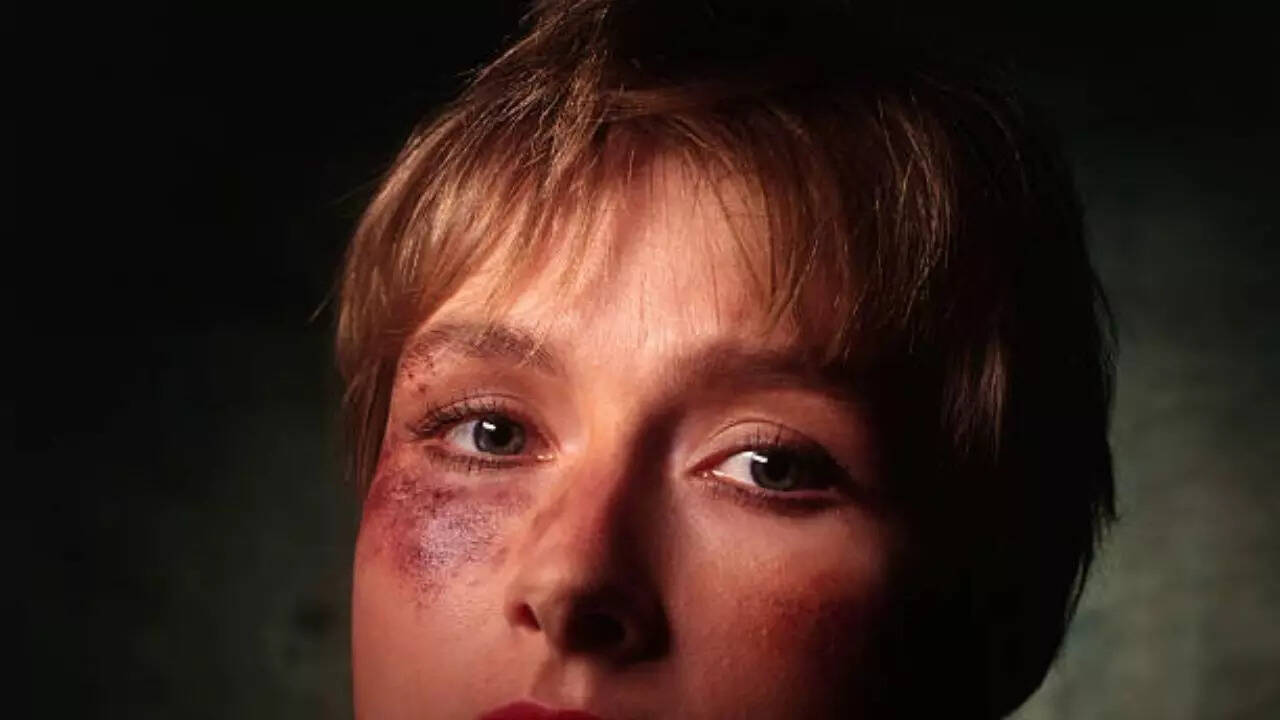 A history of pickleball-related eye injuries