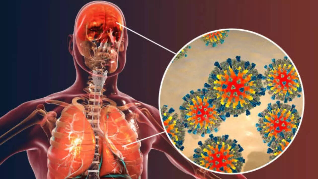 Mexico and Canada are also battling large outbreaks