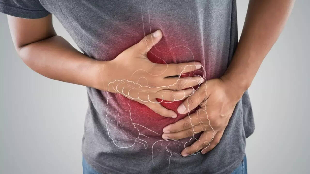 Colon cancer