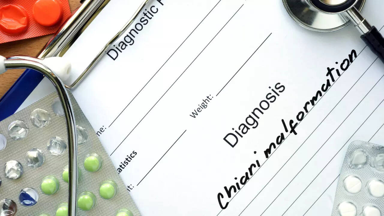 chiari malformation