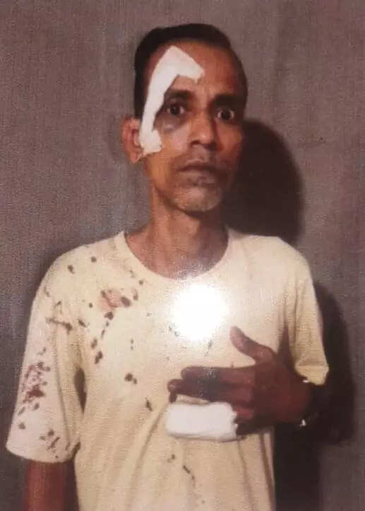 Brothers attacked in Chitpore