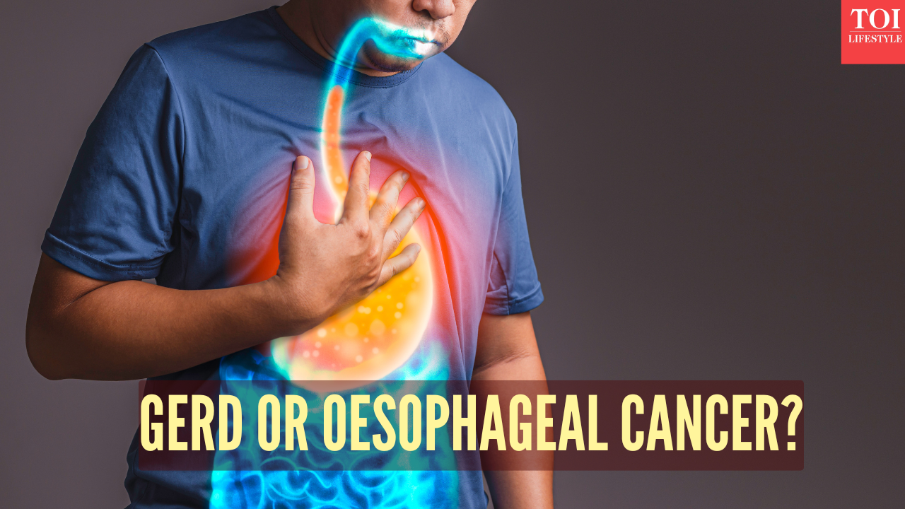 Esophageal cancer vs GERD: Symptoms, causes, and key differences
