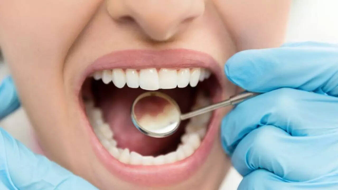Root Canal (1)